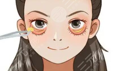 成都健丽整形口碑好不好？激光去眼袋果反馈