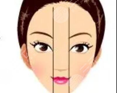 自体脂肪丰鼻唇沟真实记录前后果对比图