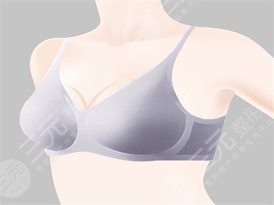 北京八大处李发成自体脂肪丰胸怎么样?李发成丰胸案例