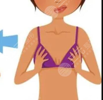 北京八大处李发成自体脂肪丰胸怎么样?李发成丰胸案例