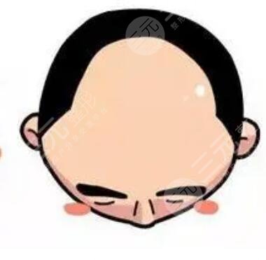 厦门碧莲盛植发医院医生介绍