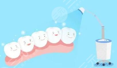 牙齿冷光美白