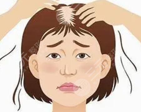 广东韩妃植发怎么样?附医院头顶植发手术经历分享