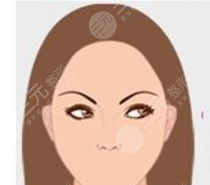 广东韩妃医疗美容医院植发经历分享