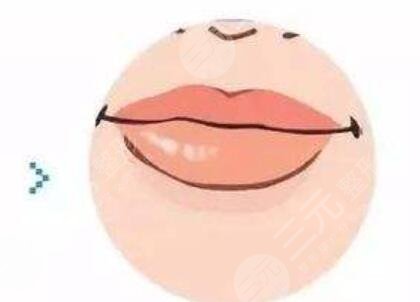 玻尿酸,注射,丰唇珠,前后,对比,果,图片