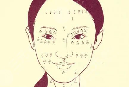 去面部色素痣手术