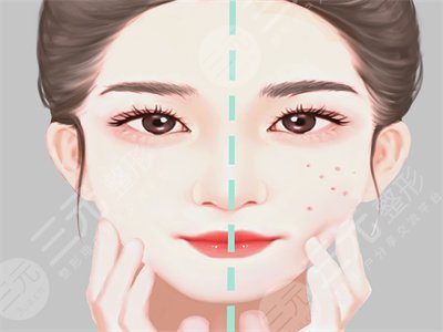 脂肪填充眼窝一年后图片