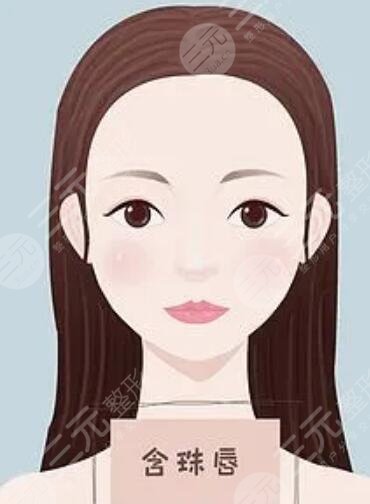 玻尿酸丰唇前后对比果图，真实案例分享