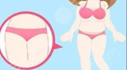 冷冻溶脂瘦腹部减肥