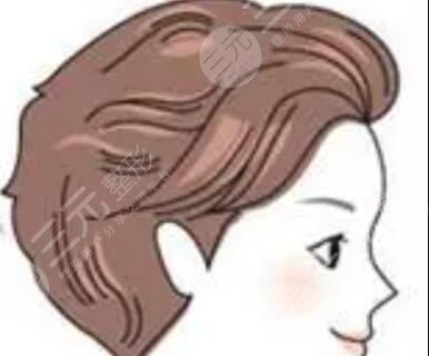 广州曙光医院植发美人尖种植经历分享