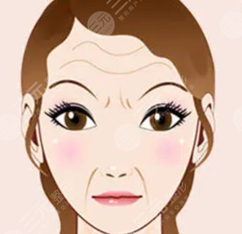 36岁女7d聚拉提做全脸面部紧致除皱案例果：术后10天