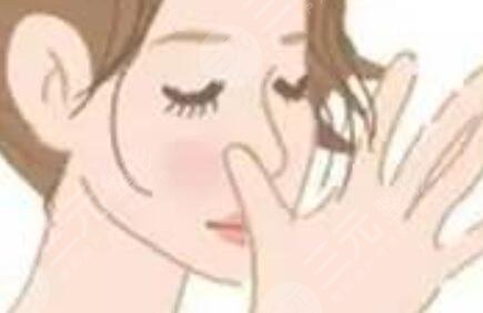 宿迁第一人民医院整形美容科隆鼻手术分享
