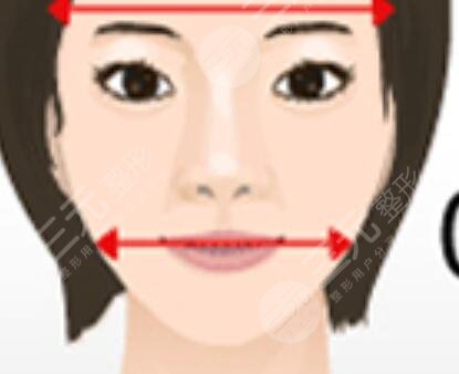 热玛吉男士前后对比