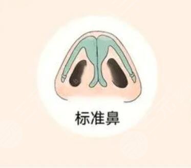 陈录翔医生怎么样？来看陈录翔鼻子案例90天的反馈~