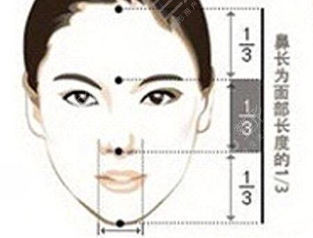 深圳向宏伟鼻整形术后7天
