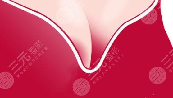 隆胸对比果展示：蜜桃胸型性感火辣！