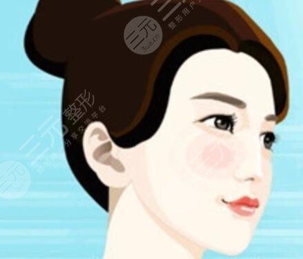 邓正军做鼻子术后4天