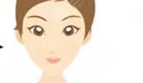 广州杜本军医生磨骨案例：从此告别了大方脸！