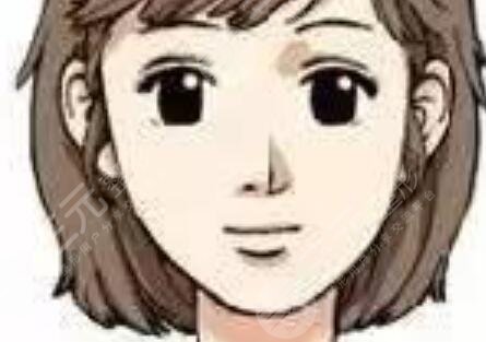 广州杜本军医生磨骨面诊