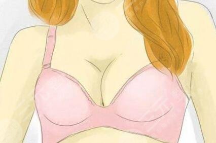 隆胸手术真人案例前