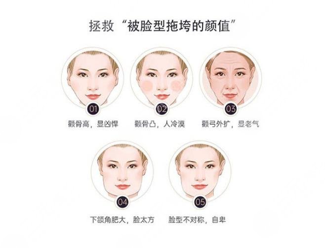 肥胖下颌角整型果图分享,土妹颜值晋级之路给你参考!