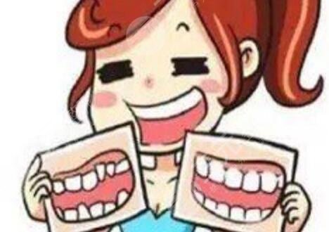 马晓辉正颌案例