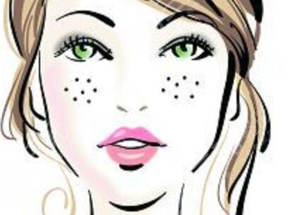 在医院祛痘后20天