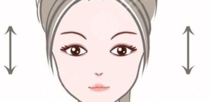 上海沈莺莺双眼皮怎么样