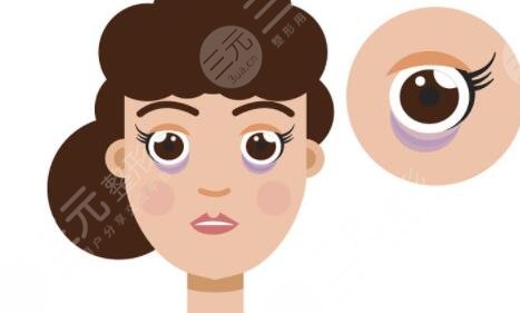 上海九院许志成去眼袋果怎么样?通过案例来了解一下