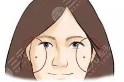 点痣后红印变化过程图