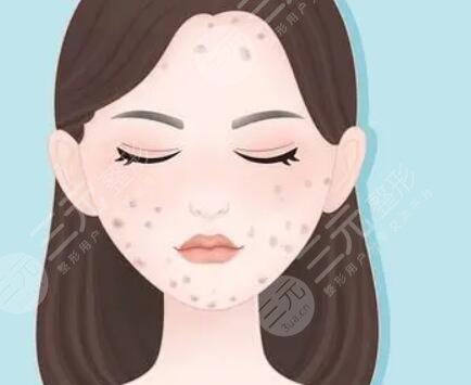 点痣后红印变化过程图