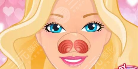 陈桂飞做鼻子好吗