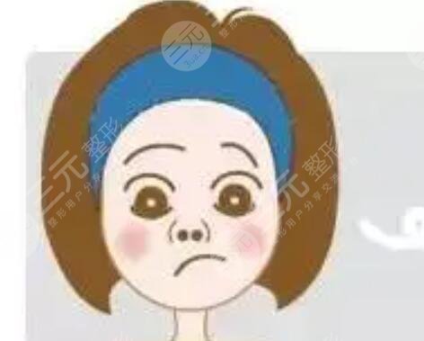 陈桂飞医生隆鼻照片