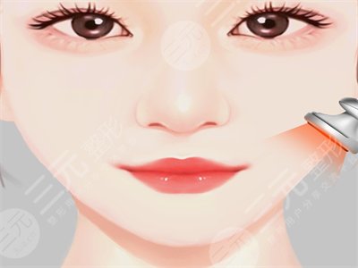 面部溶脂前后照片对比，3个月恢复正常！