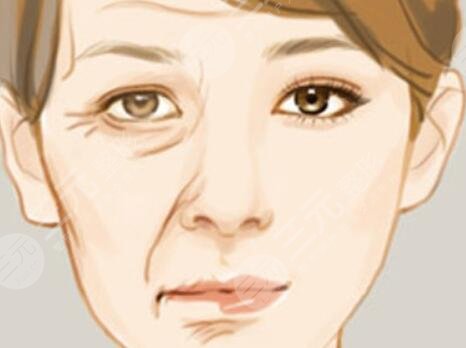 泸州医学院激光美容科价格明细表，热玛吉除皱案例呈上~