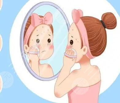 激光祛斑手术中