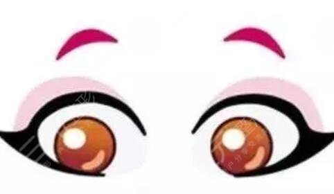 常熟一院沈春明割双眼皮手术术后一个月