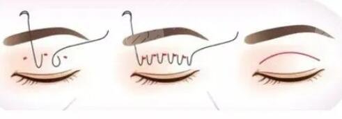 四川华西医院卿勇医生