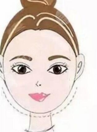 广州聂云飞医生