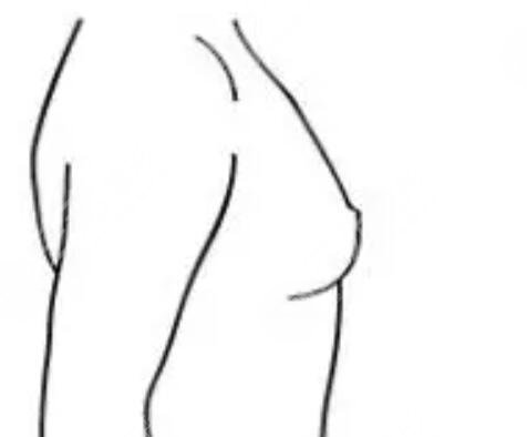 丰胸前后对比果照高清图|图片对比|对比一览！