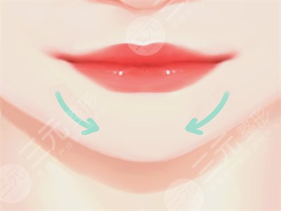 苹果肌自体脂肪填充前后对比果图片 真人日记分享