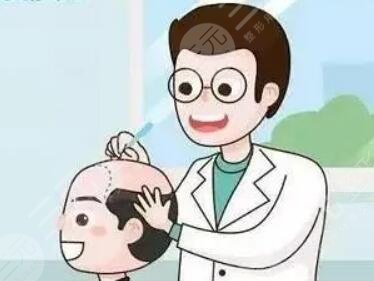 云南省第一人民医院植发经历分享