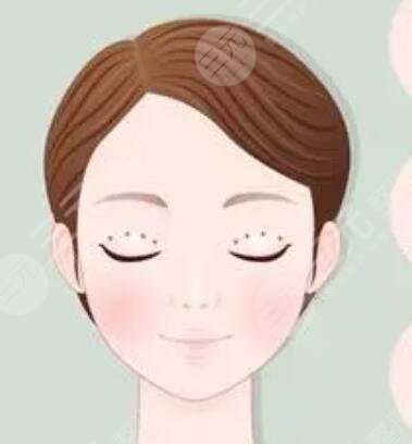双眼皮修复果图