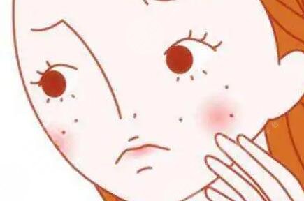 光子嫩肤前后对比照片