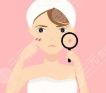 火凤凰面部溶脂果图