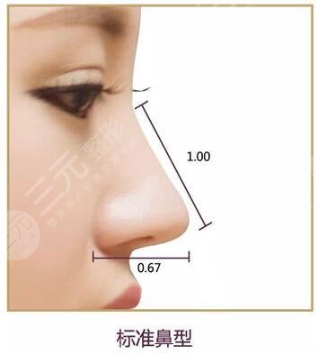 隆鼻术后注意事项