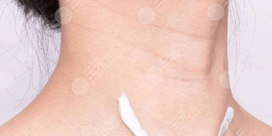 嗨体去颈纹多久打一次