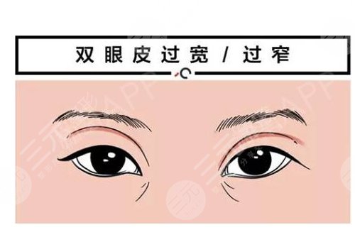 双眼皮修复之后的果怎么样