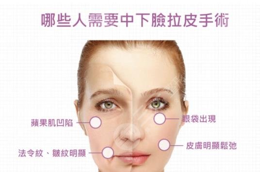 牙颌畸形手术有哪些