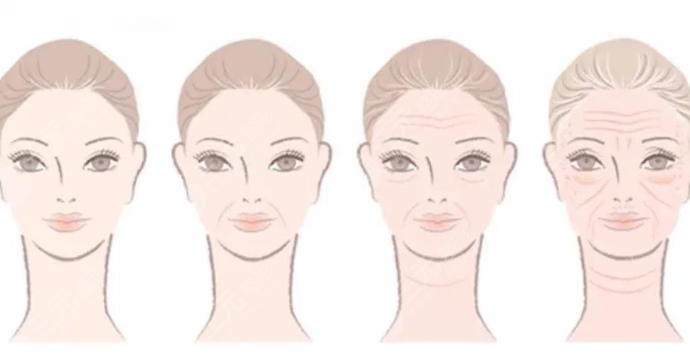 如何去抬头纹的方法有哪些?